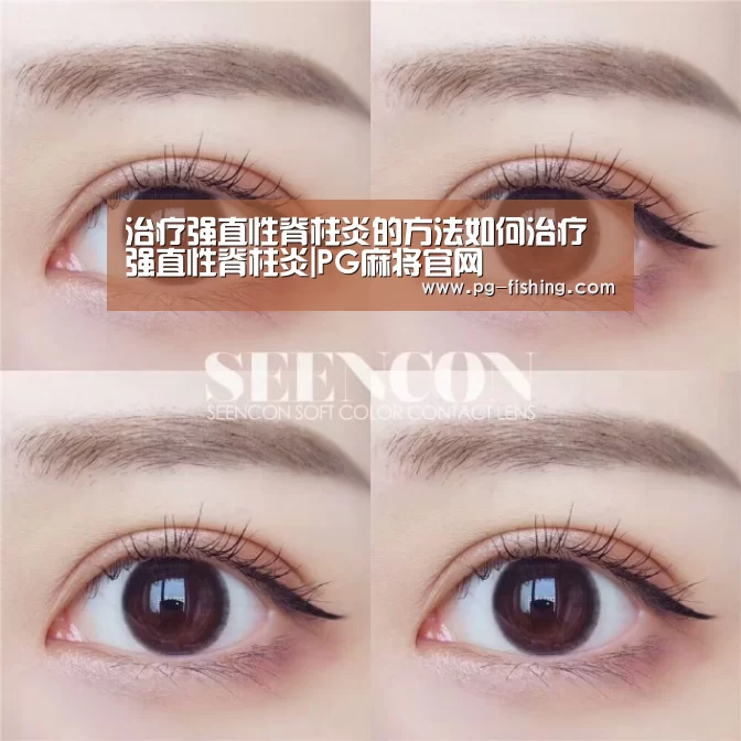 治疗强直性脊柱炎的方法如何治疗强直性脊柱炎|PG麻将官网(图1) PG电子老虎机