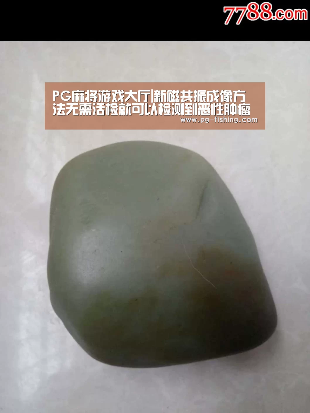 PG麻将游戏大厅|新磁共振成像方法无需活检就可以检测到恶性肿瘤(图1) PG电子老虎机