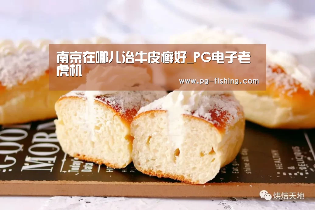 南京在哪儿治牛皮癣好_PG电子老虎机(图2) PG麻将游戏大厅